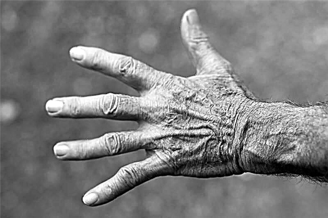 Eczema nas mans: como tratar, tipos e síntomas, remedios axeitados